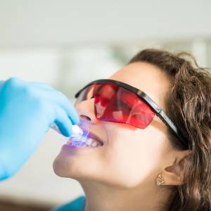 The Science Behind Teeth Whitening Garden City: How It Works